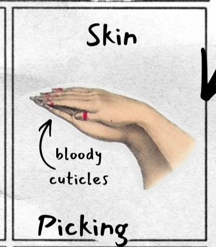 Right box is labeled Skin. Two hands appear with an arrow pointing to the words bloody cuticles above the word Picking.